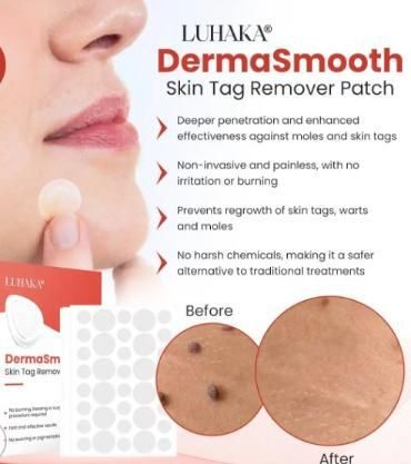 Skin Tag Remover Patch- provides safe removal.